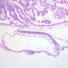 Poetry by Roberto&nbsp;Ascalon